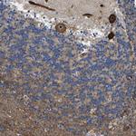 KIAA1551 Antibody in Immunohistochemistry (IHC)