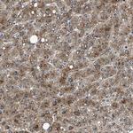 NEU1 Polyclonal Antibody