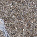 APOBEC4 Polyclonal Antibody