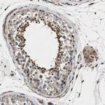 HSPA12B Antibody in Immunohistochemistry (IHC)