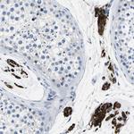 TSPAN2 Antibody in Immunohistochemistry (Paraffin) (IHC (P))