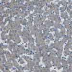 AFAP Antibody in Immunohistochemistry (Paraffin) (IHC (P))