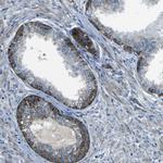 AFAP Antibody in Immunohistochemistry (Paraffin) (IHC (P))