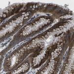 GDF5 Polyclonal Antibody