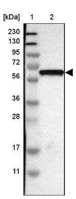 GDF5 Antibody in Western Blot (WB)