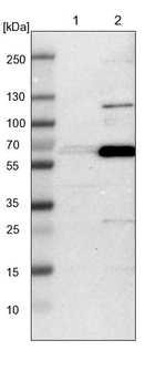 GDF5 Antibody in Western Blot (WB)