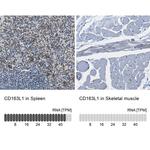 CD163L1 Antibody in Immunohistochemistry (IHC)
