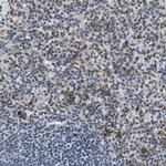 CD163L1 Antibody in Immunohistochemistry (IHC)