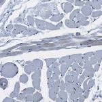 CD163L1 Antibody in Immunohistochemistry (IHC)
