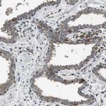PALD1 Antibody in Immunohistochemistry (IHC)