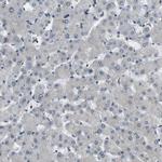 PALD1 Antibody in Immunohistochemistry (IHC)