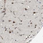 PALD1 Antibody in Immunohistochemistry (IHC)