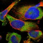 FAM69A Polyclonal Antibody
