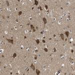 FAM69A Antibody in Immunohistochemistry (Paraffin) (IHC (P))