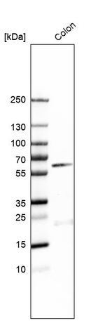 B4GALNT2 Antibody in Western Blot (WB)