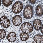 CDH26 Antibody in Immunohistochemistry (Paraffin) (IHC (P))