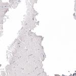 GP2 Antibody in Immunohistochemistry (Paraffin) (IHC (P))