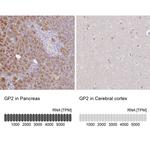 GP2 Antibody in Immunohistochemistry (IHC)