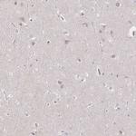 GP2 Antibody in Immunohistochemistry (IHC)