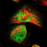 SRM Polyclonal Antibody