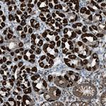 SRM Antibody in Immunohistochemistry (Paraffin) (IHC (P))