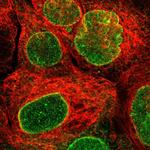 TMX4 Polyclonal Antibody