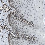 TMX4 Antibody in Immunohistochemistry (Paraffin) (IHC (P))