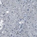 TMX4 Antibody in Immunohistochemistry (Paraffin) (IHC (P))
