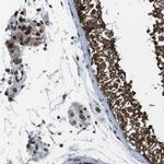 TMX4 Antibody in Immunohistochemistry (IHC)