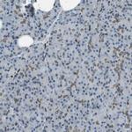 TMX4 Antibody in Immunohistochemistry (IHC)