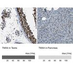 TMX4 Antibody