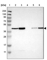 TMX4 Antibody in Western Blot (WB)