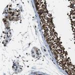 TMX4 Antibody in Immunohistochemistry (IHC)