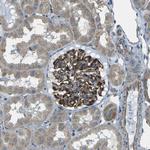SLK Antibody in Immunohistochemistry (Paraffin) (IHC (P))