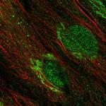 PFTK2 Polyclonal Antibody