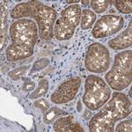 PFTK2 Antibody in Immunohistochemistry (Paraffin) (IHC (P))