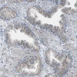 ZNF516 Antibody in Immunohistochemistry (Paraffin) (IHC (P))