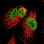 SPEN Antibody in Immunocytochemistry (ICC/IF)