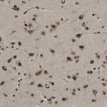 SPEN Antibody in Immunohistochemistry (Paraffin) (IHC (P))