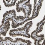 SPEN Antibody in Immunohistochemistry (Paraffin) (IHC (P))