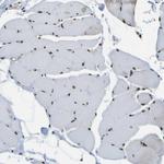 SPEN Antibody in Immunohistochemistry (Paraffin) (IHC (P))