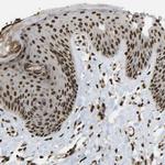 SPEN Antibody in Immunohistochemistry (Paraffin) (IHC (P))