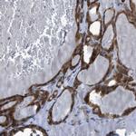 RBBP9 Polyclonal Antibody