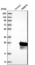 RBBP9 Antibody in Western Blot (WB)