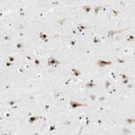 RNF38 Antibody in Immunohistochemistry (Paraffin) (IHC (P))