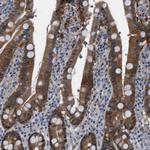 TMEM45B Polyclonal Antibody