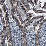 FAM3B Antibody in Immunohistochemistry (IHC)