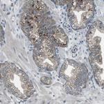 FAM3B Antibody in Immunohistochemistry (IHC)