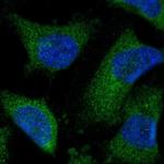 CISD2 Polyclonal Antibody