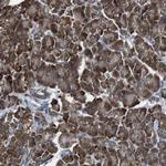 CISD2 Antibody in Immunohistochemistry (Paraffin) (IHC (P))